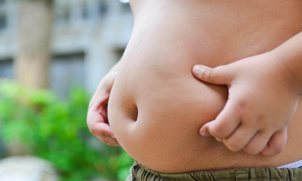 CCSS atendió niños por problemas de obesidad