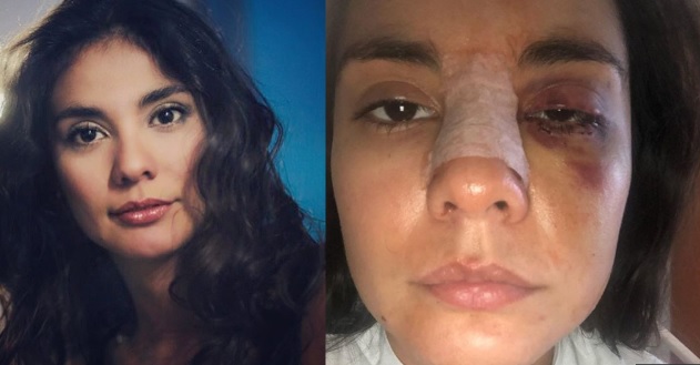 Campaña #NiUnaMenos en solidaridad con actriz colombiana que fue agredida 