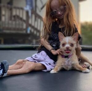 Influencer con envejecimiento prematuro fallece a los 15 años. Imagen: @AdaliaRose Influencer con envejecimiento prematuro fallece a los 15 años. Imagen: @AdaliaRose