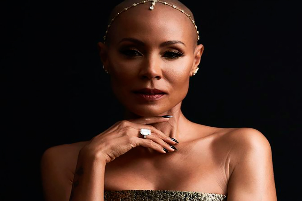 Alopecia: La enfermedad por la que lucha la esposa de Will Smith
