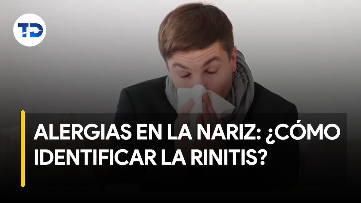Alergias en la nariz ¿cómo identificar la rinitis? Telediario Costa Rica
