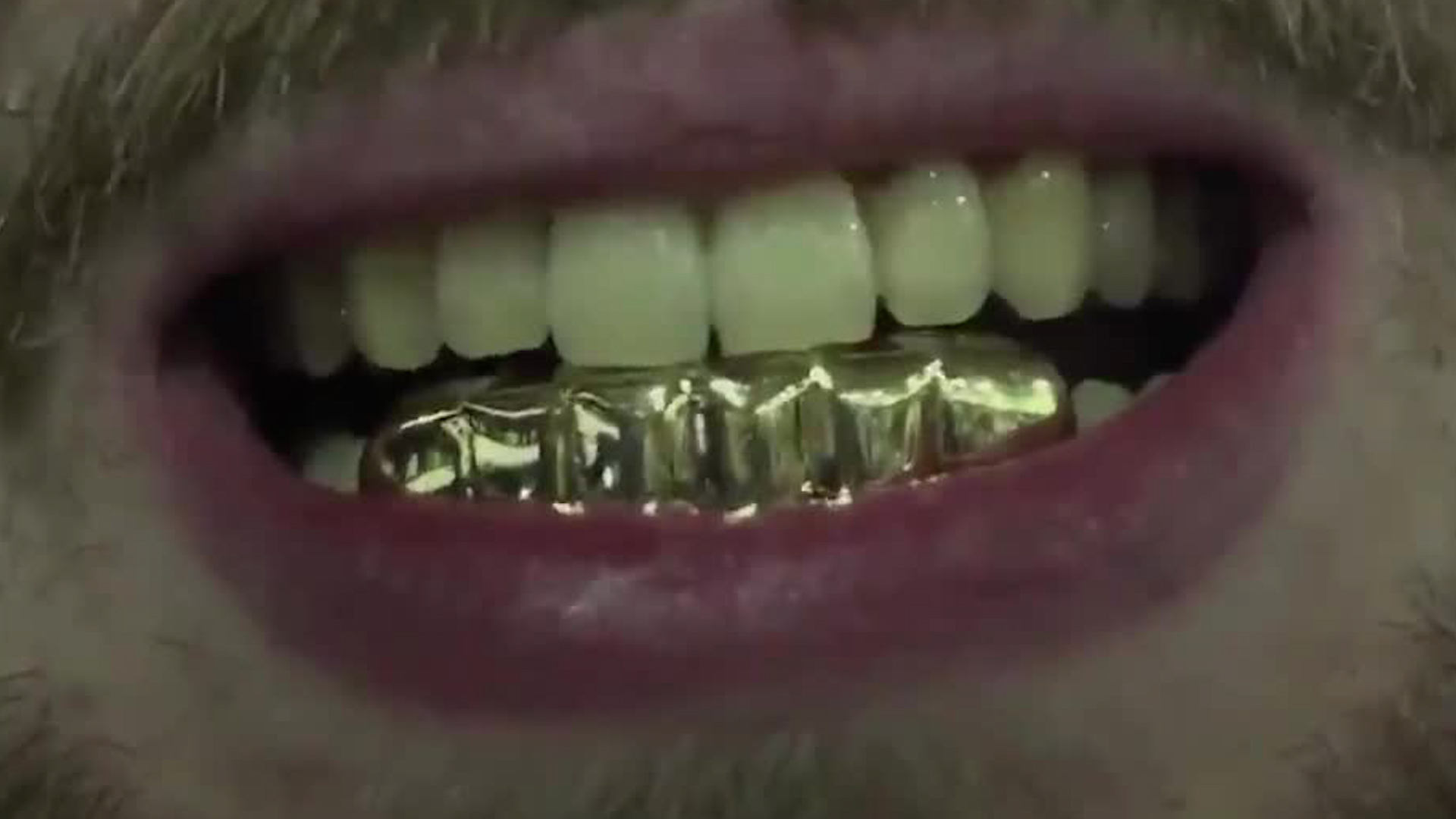 ‘Grills’ no tiene registro sanitario y se venden en redes sociales