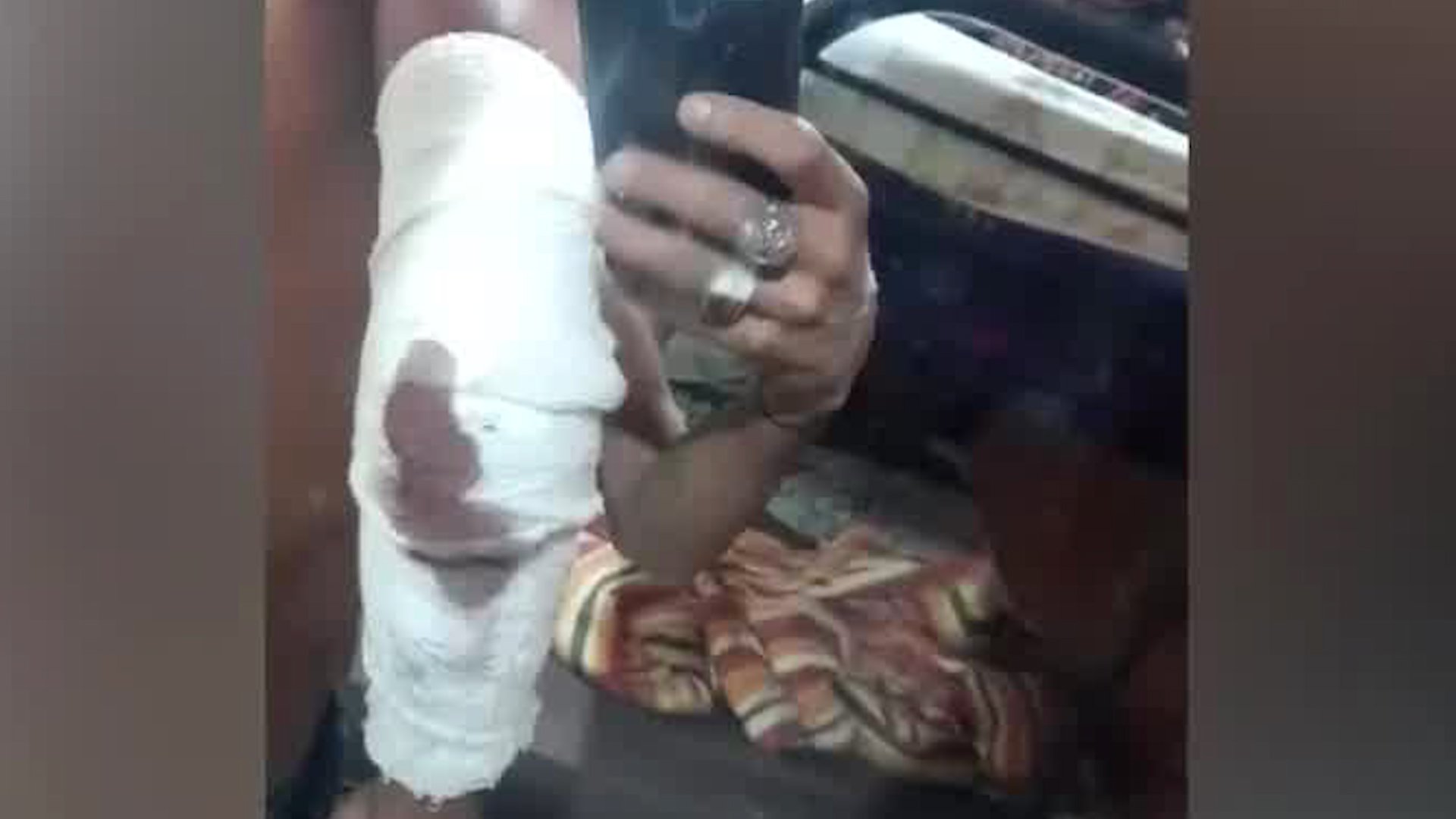 Obrero denuncia golpiza por parte de policías en Heredia