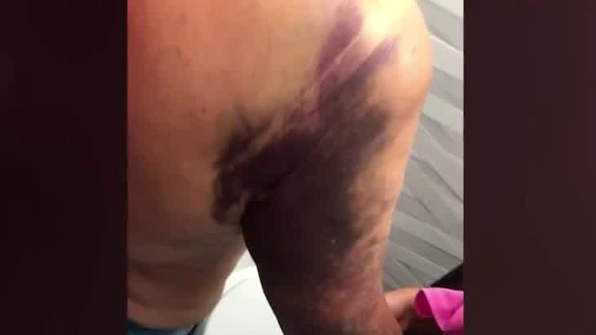 Adulta mayor de 82 años es golpeada por su hijo | FOTOS