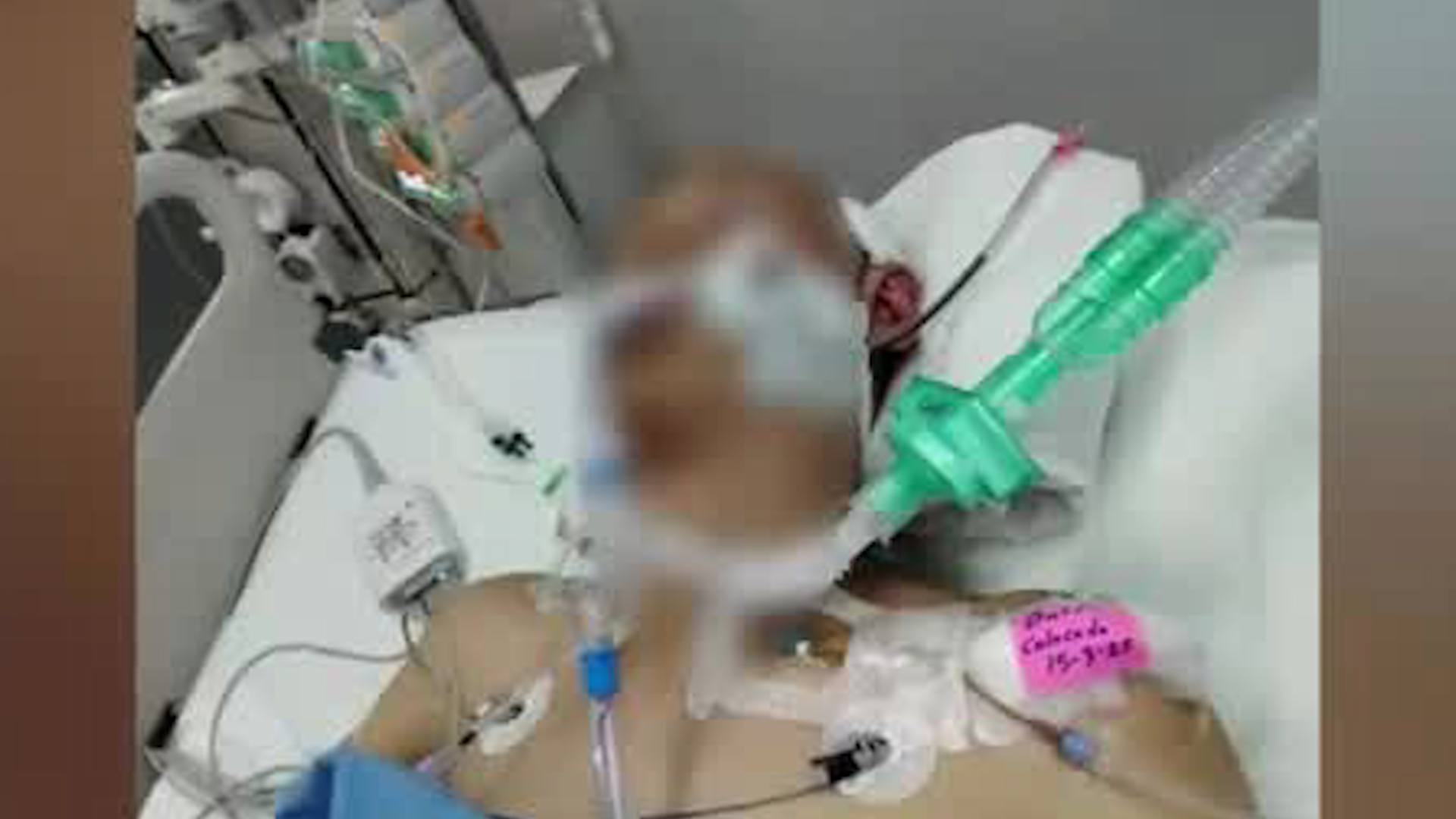 Familia clama ayuda para hombre con trauma grave Familia clama ayuda para hombre con trauma grave