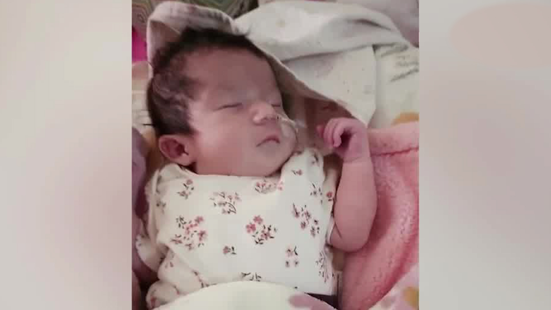 Bebé de 3 meses requiere cirugía cardíaca urgente