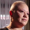 Mujer recibe diagnóstico de cáncer días después de su boda Mujer recibe diagnóstico de cáncer días después de su boda