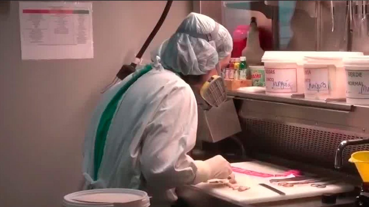 Cáncer de colon está afectando a personas jóvenes