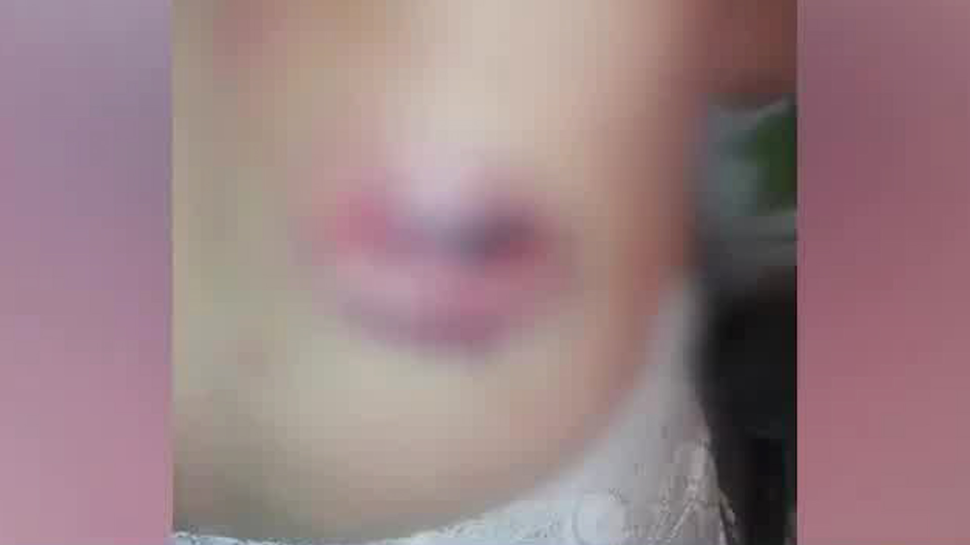 Mujer narra momento en que fue herida por una bala perdida | VIDEO