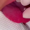 Estos son los riesgos ocultos de los piercings en la lengua