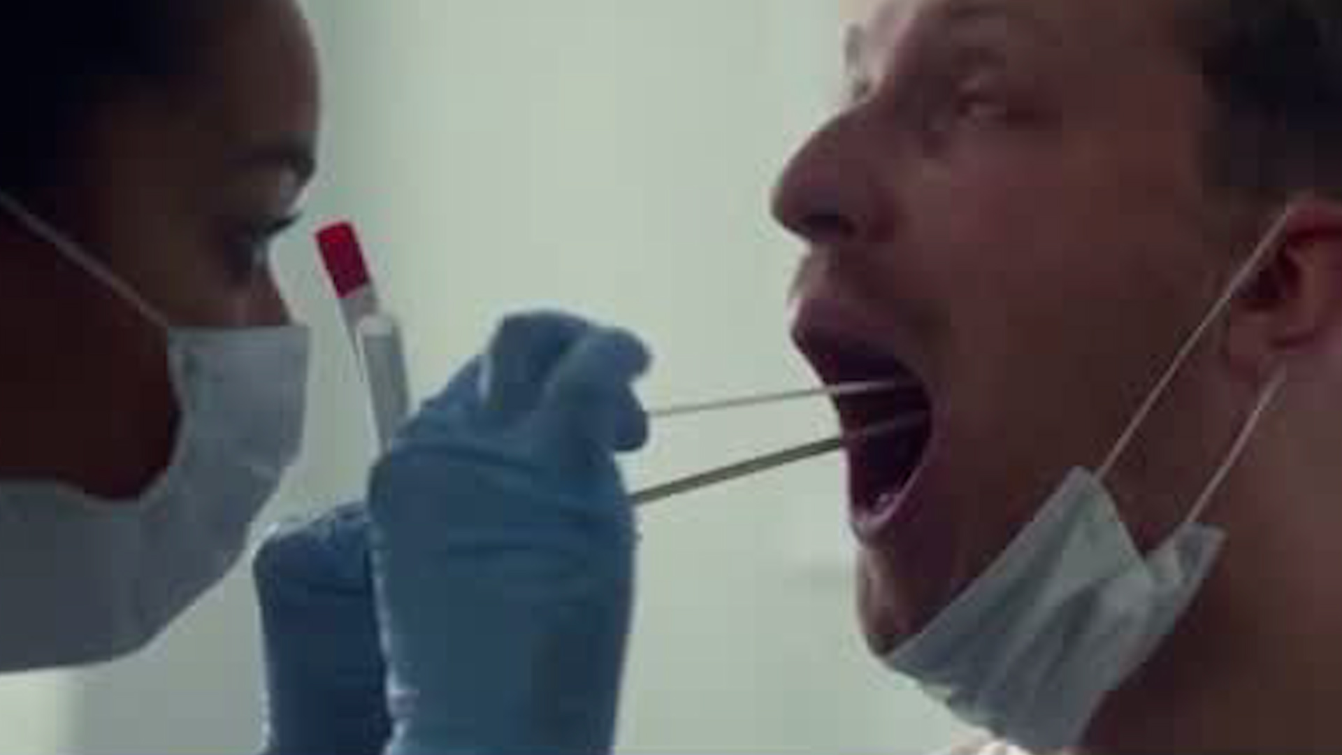 Cáncer bucal: Aumentan los casos en jóvenes