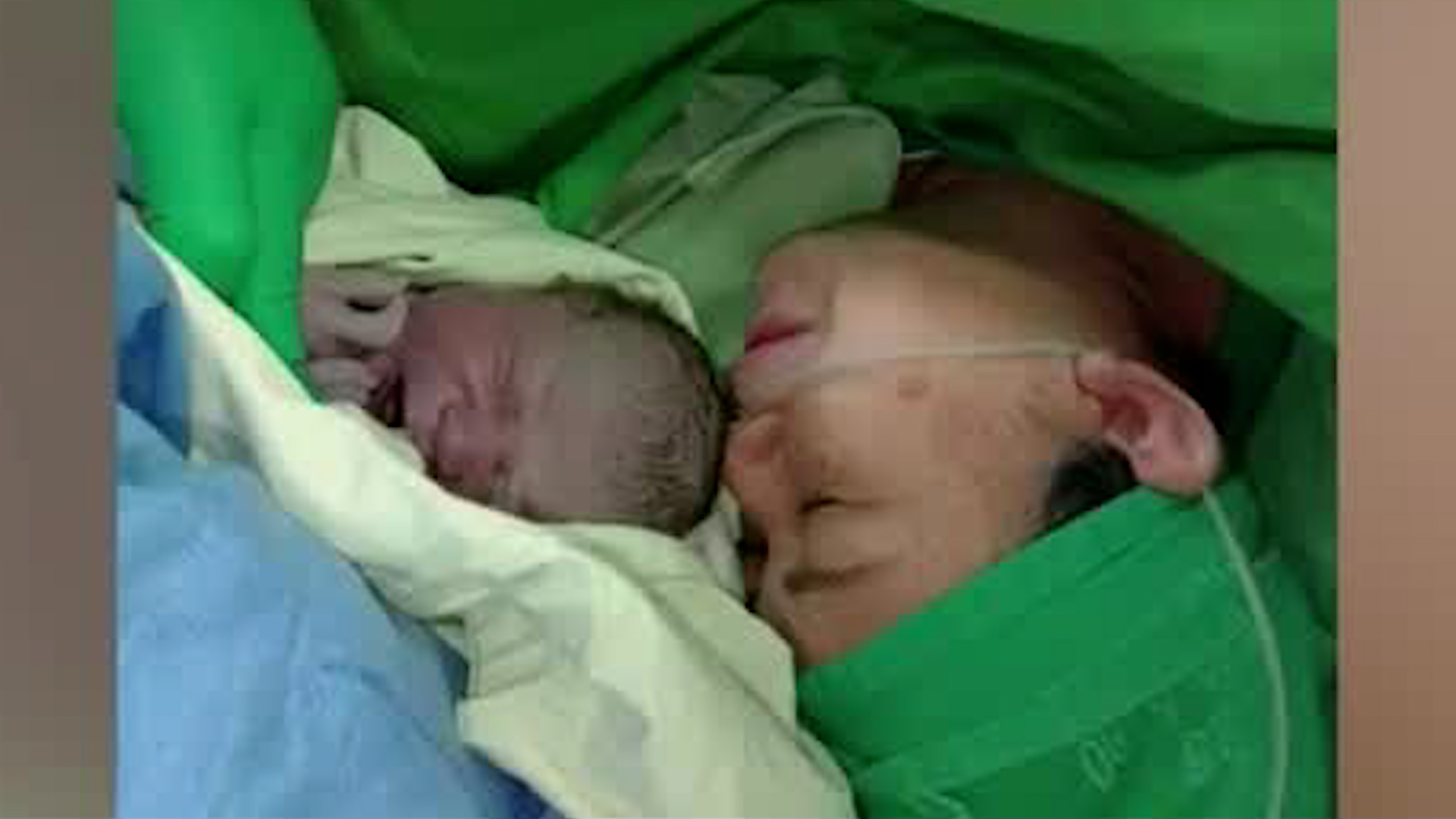 Bebé necesita cirugía urgente