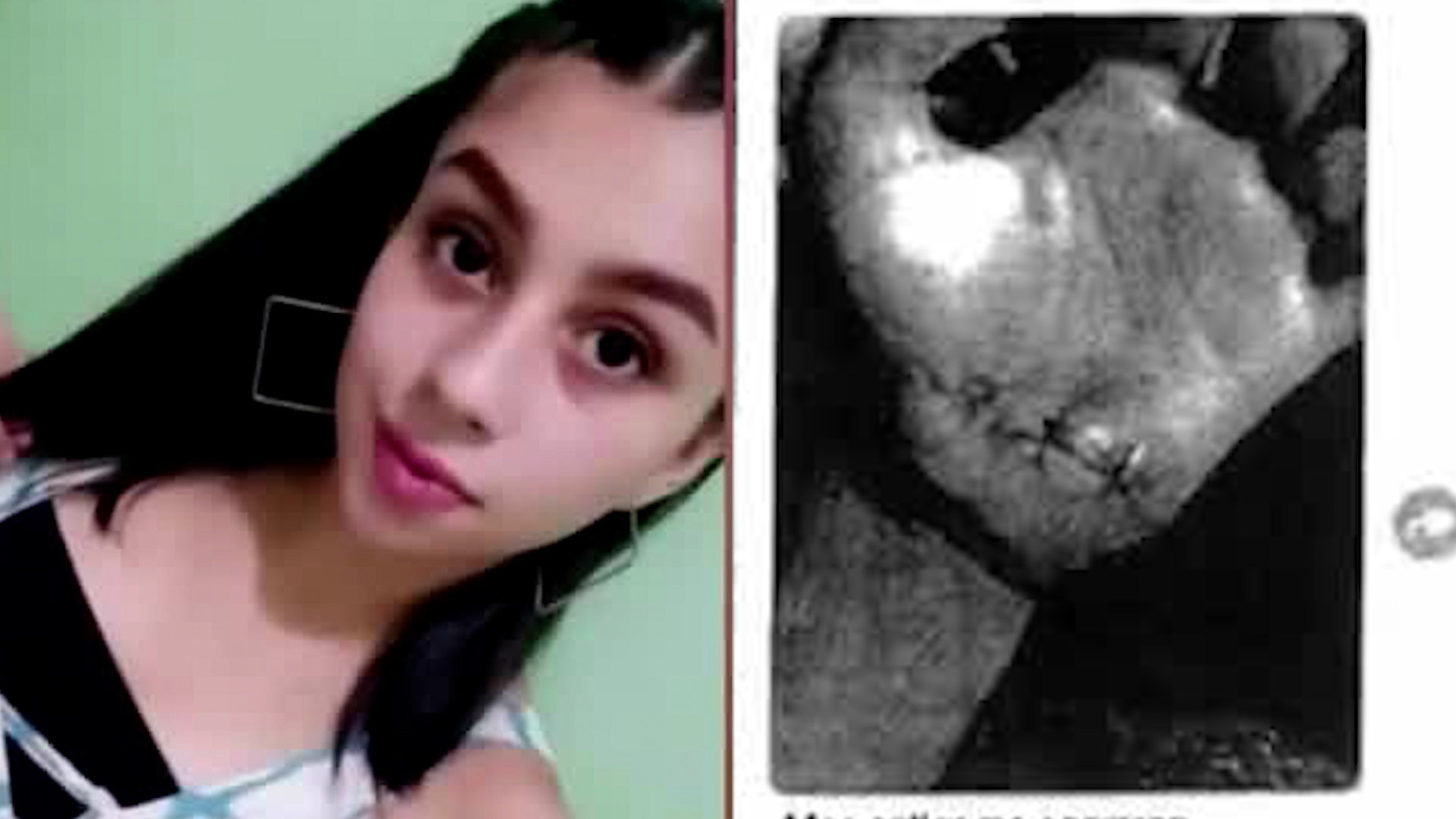 Caso Nadia Peraza: Perito confirmó que huellas eran de la joven