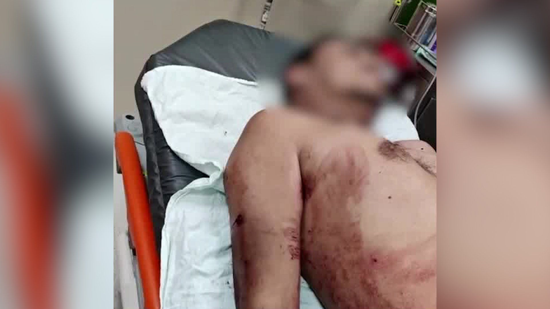 Ataque con más de 30 balazos deja un muerto en Guanacaste