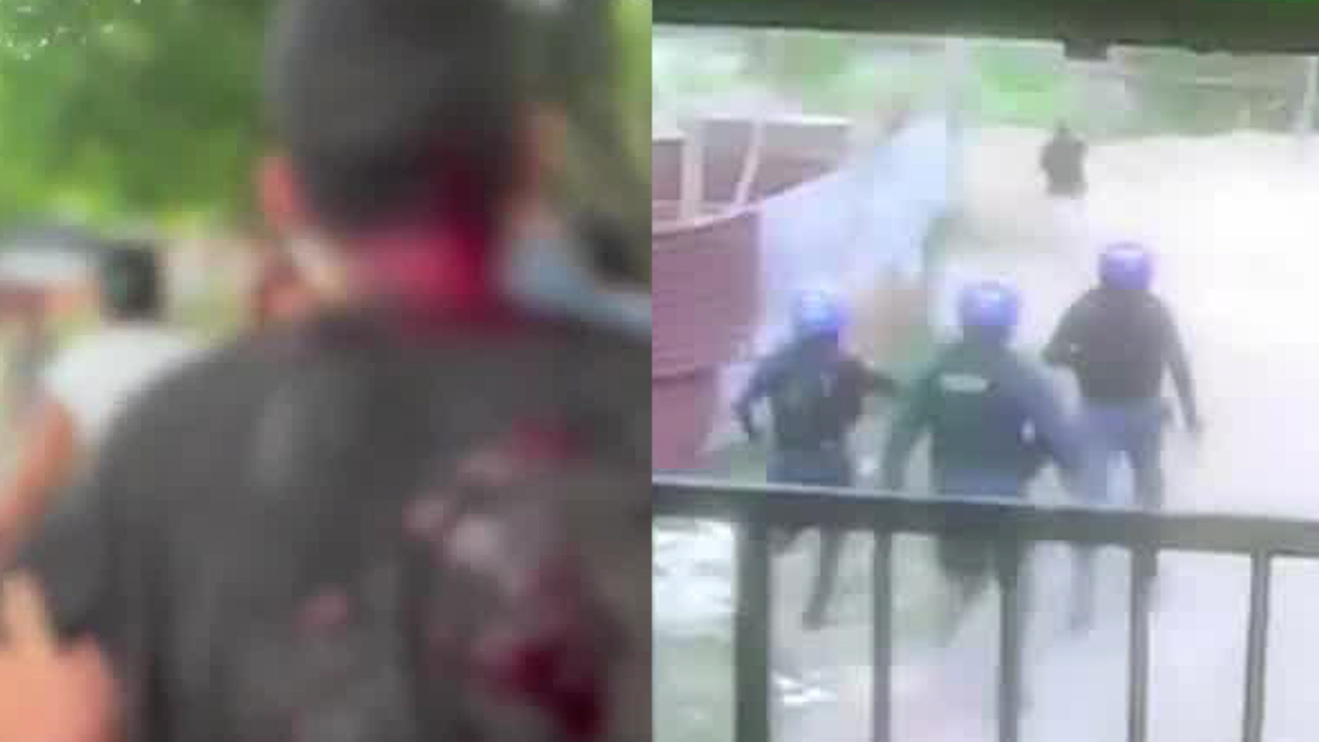 Joven recibe disparo en intervención policial | VIDEO