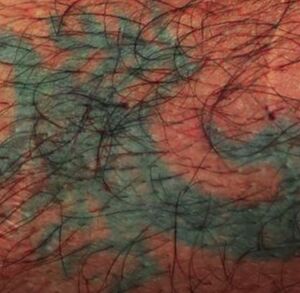 La víctima murió en el centro médico. (OIJ)