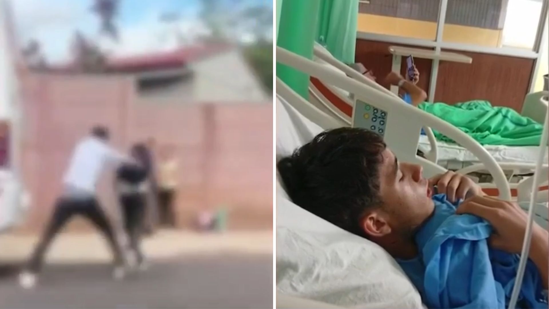 Adolescente sufre fractura en mandíbula tras agresión